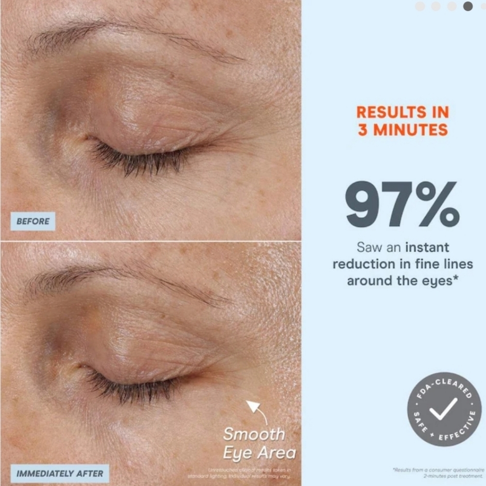 NuFace FIX MicroWand - Sleek White Design - Picture 8 of 16